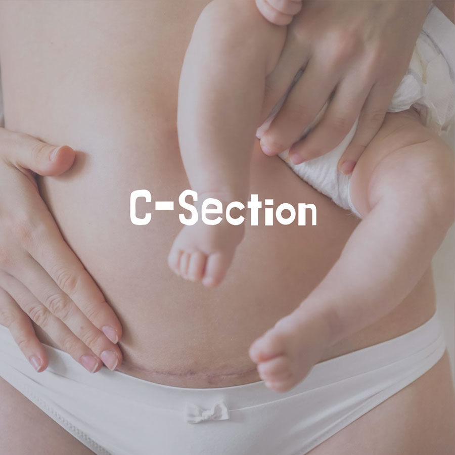 Private Positive C-Section Course over Zoom (Full course £225)